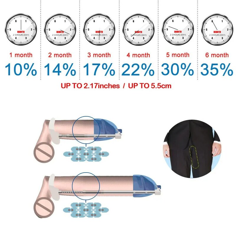 Male Penis Extender Enlargement Vacuum Cup Plastic Top Cradle Head Hanger Sex Toy Men Dick Glans Pump Stretcher Enlarger System
