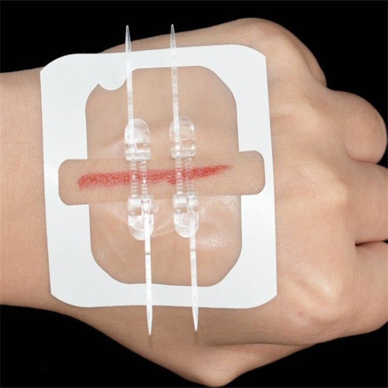 Parche hemostático portátil para exteriores, accesorio de sutura rápida para ayuda de banda con cremallera, 2 piezas