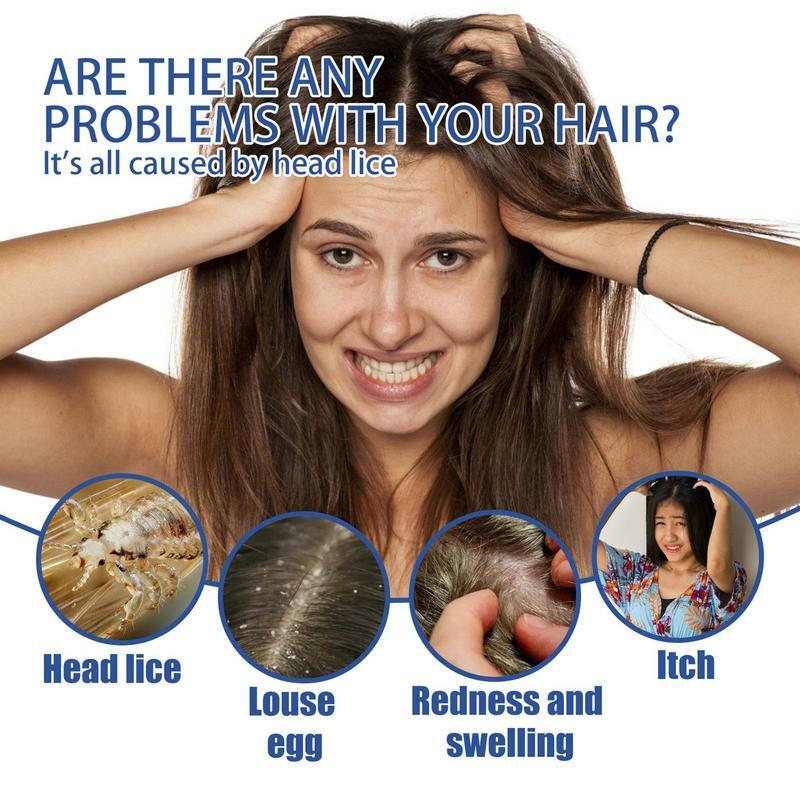 Spray Anti-Poux pour Cheveux pour Enfant, 30ml, Ingrédients Naturels 402, Efficace 03/Usage