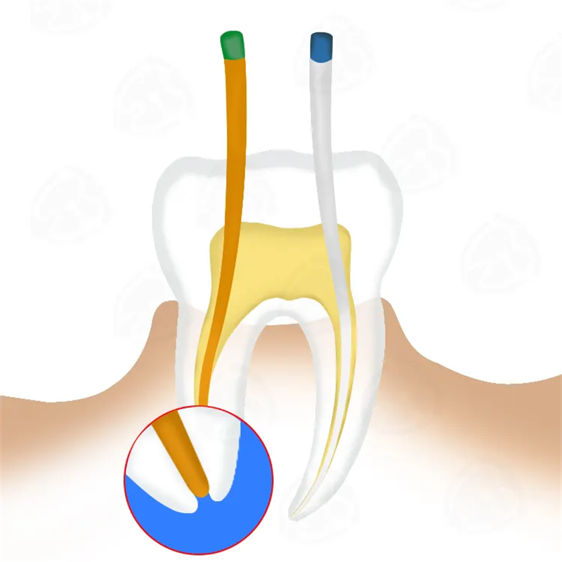 Puntas de fibra de algodón para odontología, materiales para Guta Dental, Percha para puntos de raíz, GP Canal Taper 02 04 06 #15-40 F1-F3, 10 cajas