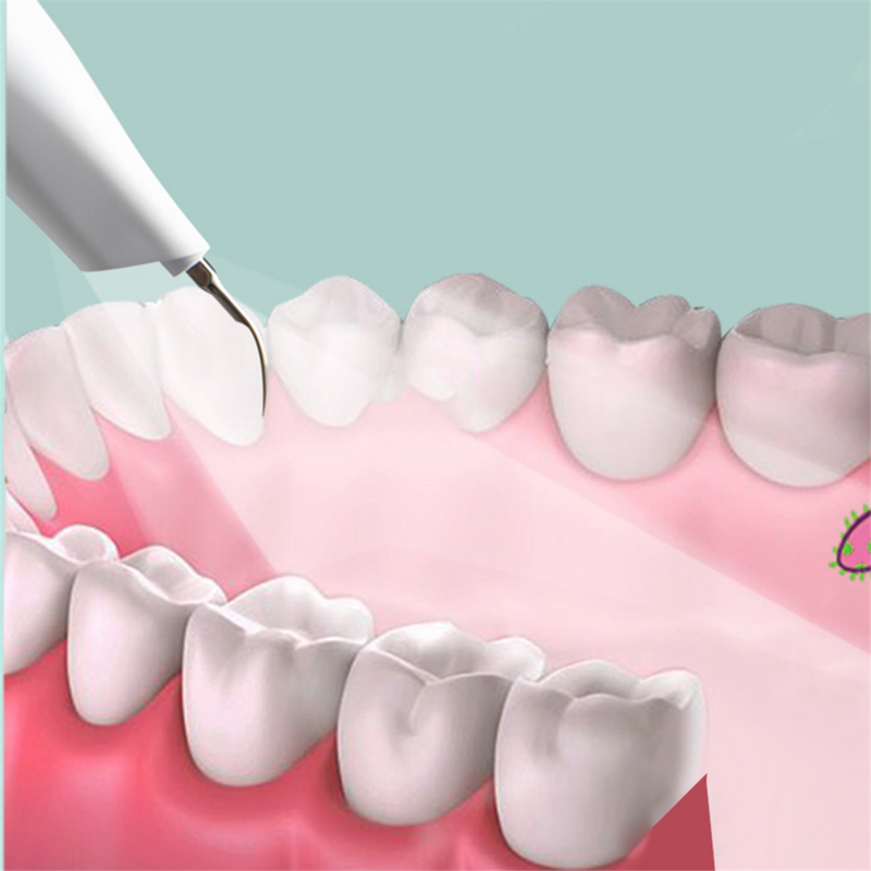 Ультразвуковой очиститель зубов для собак и кошек, ультразвуковой стоматологический набор, стоматологический очиститель