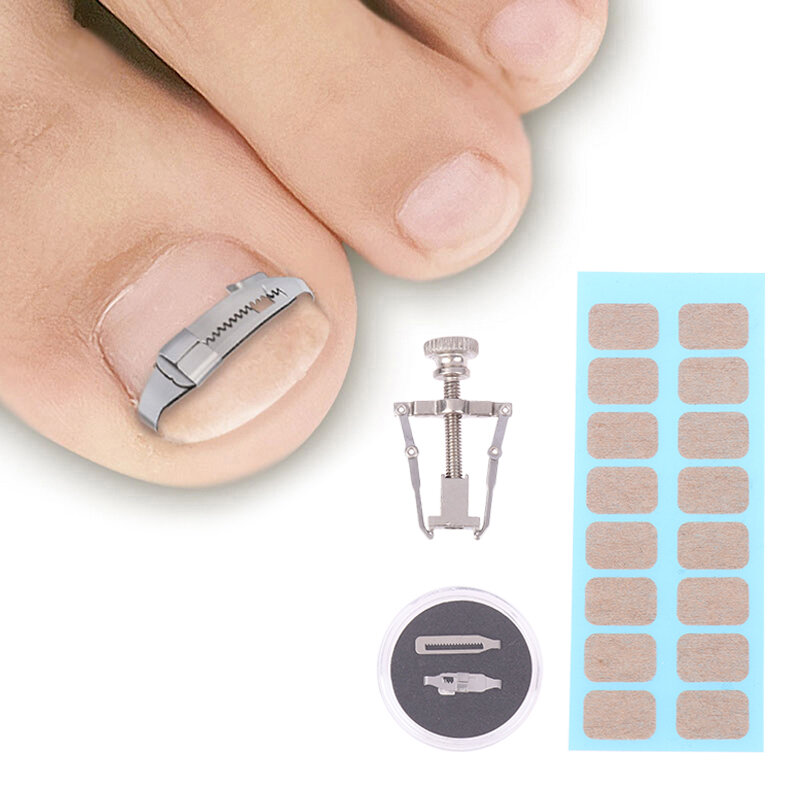 1 zestaw narzędzi do korektora paznokci wrośnięty Pedicure odzyskuje Embed noe terapia na paznokcie profesjonalna pielęgnacja stóp narzędzie do korekcji pielęgnacja stóp