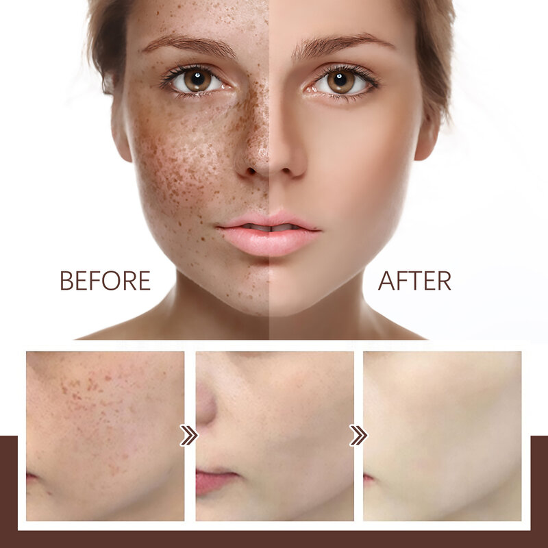 Peel Off Mask Freckle Removal Fade Dark Spot Chloasma Oil Control Anti Aging Remove Wrinkle Brighten Mositurizing Whitening Mask