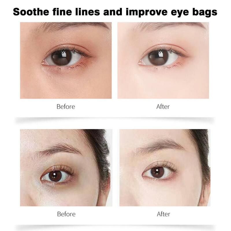 Anti-Wrinkle Eye Cream Fades Fine Lines Dark Circles Puffiness Care Remove Bags 30g Firmness Eye Serum Anti-Aging Eye Eye L7R3
