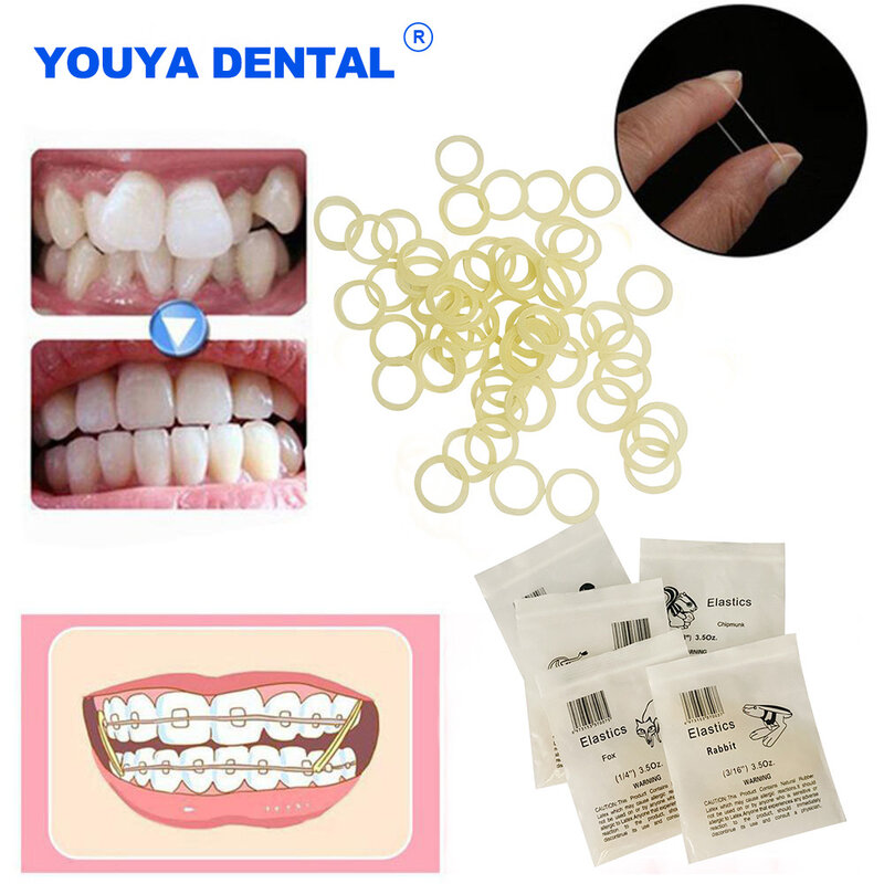 Anneaux élastiques dentaires en latex, 100 pièces/sac, élastiques dentaires, accolades, élastiques dentaires, non-CU, matériaux 3.5oz, élastiques pour dentistes