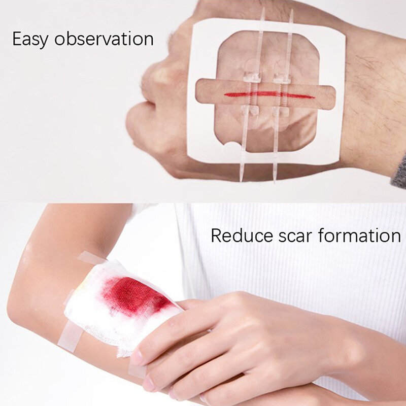 Attrezzatura da campeggio sutura indolore adesivo chiusura della ferita cerotto per aiuto alla ferita assistenza emostatica veloce fascia sanitaria accessori per sutura
