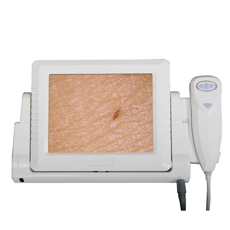 Máquina do analisador da pele, dispositivo facial dos testes da pele, uso home