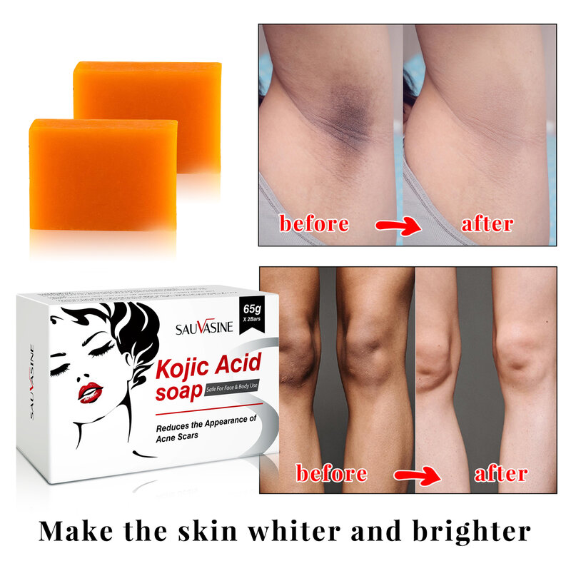 2 PCS Kit Kojic Acid Whitening Soap 65g Handmake Black Drak Spot Melasma Remover Brightening Glowing Skin Smooth Moisturized
