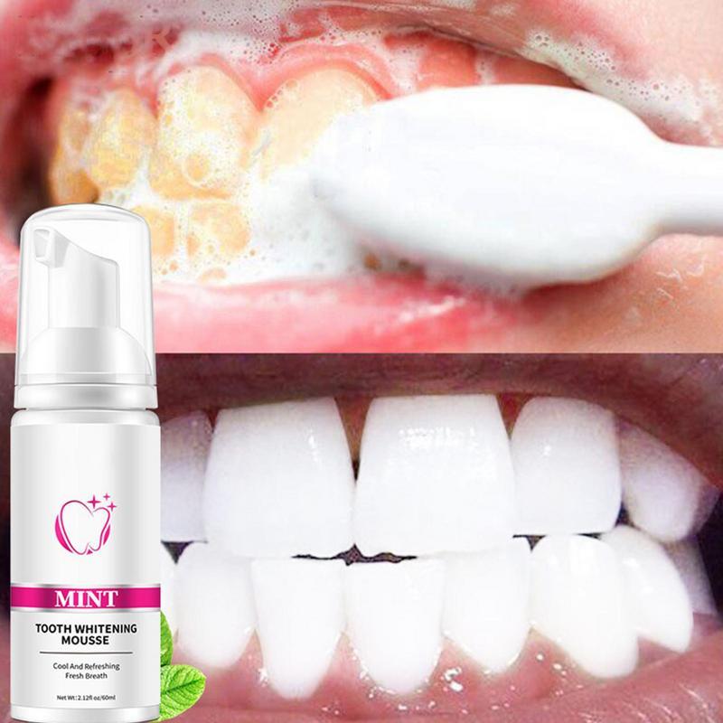 Whitening Tandpasta Tanden Reinigende Mousse Verwijdert Vlekken Reparatie Hygiëne Mousse Bleken En Vlekken Tanden Nieuw