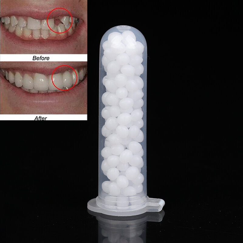 1Box temporäres Zahn reparatur set Zähne und Lücken falsche Zähne fester Kleber Zahn Beauty Tool Prothesen kleber Zahn aufhellung