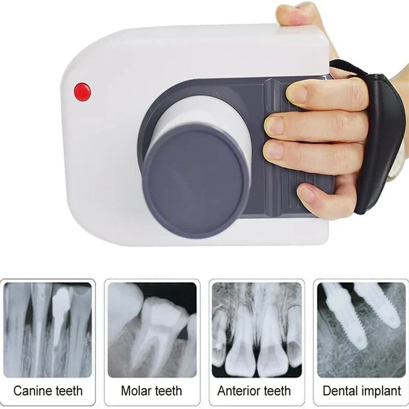 Mobile Tragbare Dental X-Ray Maschine Oral Digital X-Ray Einheit Bild Gerät Tragbare Zahn Digitale X-ray Handheld XRAY Einheit