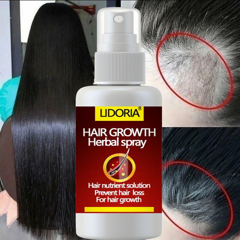 Hair Growth Serum Spray Fast Hair Growth Liquid Treatment Scalp Hair Follicle Anti Hair Loss Natural Beauty Health Hair Care