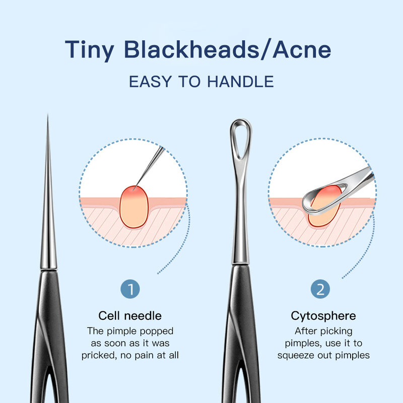 Acne agulha cravo clip removedor extração popper poro preto cabeça limpador rosto cuidados com a pele limpeza profunda ferramenta de agulha