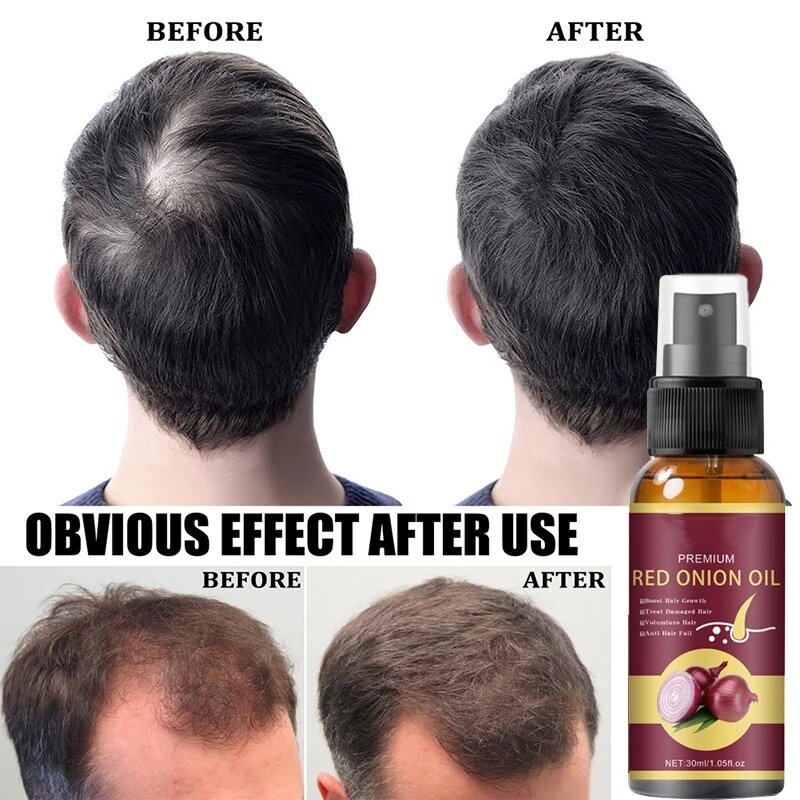 Powerful Hair Growth Serum Spray Repair Hair Nourish Root Regrowth Hair Anti Hair Loss Treatment Essence For Men Women Hair Care