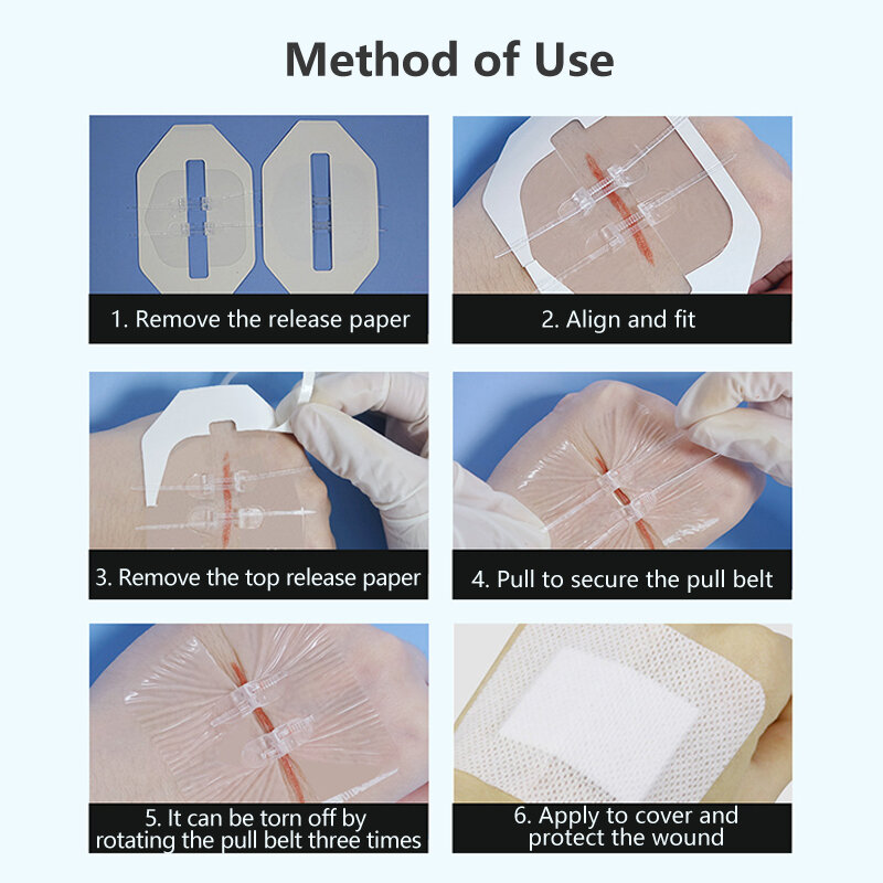 2Pcs Zipper Band-Aid Zipper Tie Wound Closure Patch Hemostatic Patch Wound Fast Suture Zipper Band-Aid Outdoor Portable