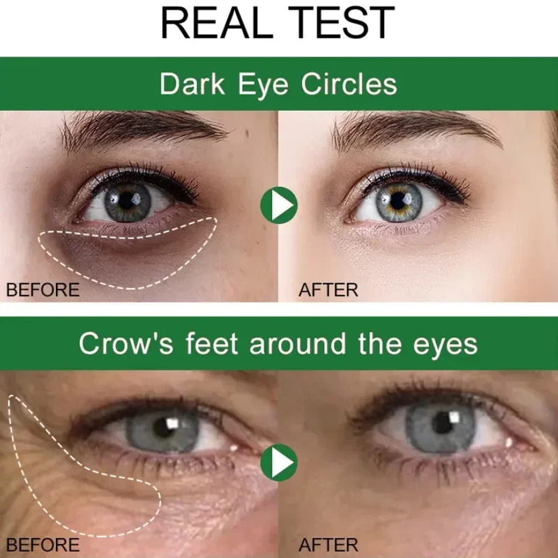 Anti-Augenringe Taschen sofort entfernen Falten Augen creme Schwellungen verblassen Auge feine Linie straffen Weiß unter den Augen Hautpflege