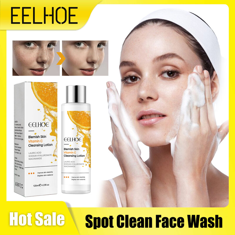Rimozione lentiggine detergente per il viso controllo dell'olio pigmentazione correttore di melanina idratare pulito rimozione delle macchie dei pori lozione per il lavaggio del viso