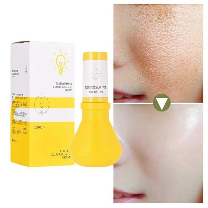 Colloidal Sulfur Acne Skin Serum Anti Aging Face Whitening Moisturize Care Facial Beauty Serum Hyaluronic Skin Health X2O5