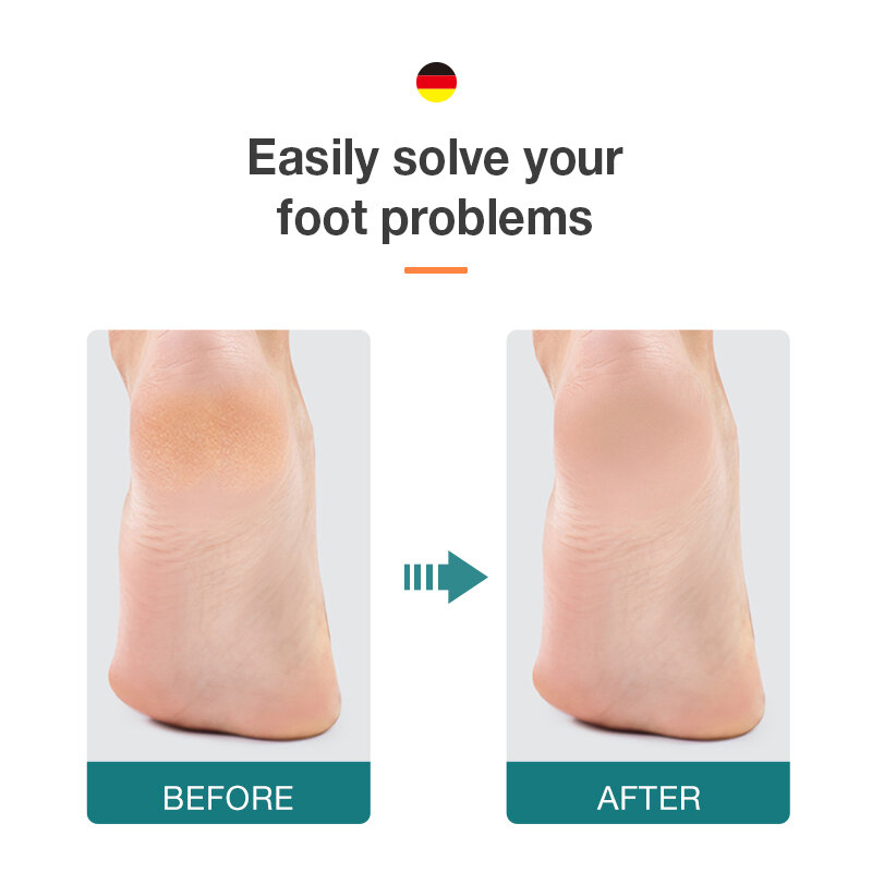 Двусторонняя пилка для ног MR.GREEN, средство для удаления мозолей для омертвевшей кожи, профессиональные инструменты для педикюра, скребок для удаления мозолей, шлифовальная машинка для ног