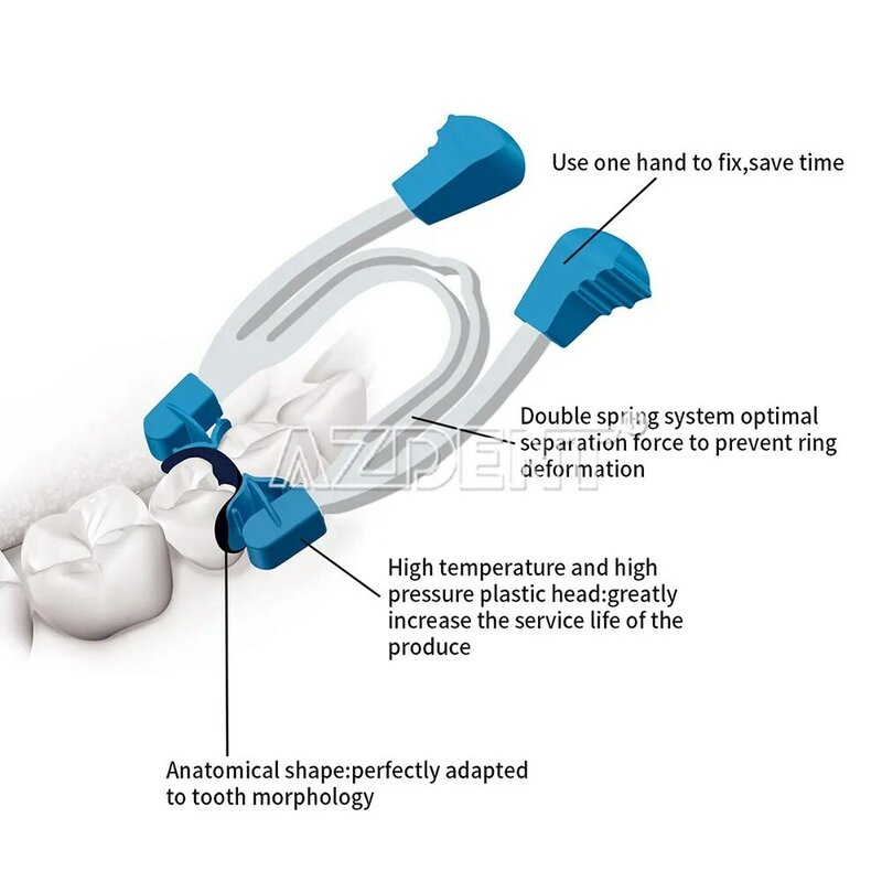 Azdent-Clip de resorte de Metal contorneado para dentistas, herramientas de anillo de matriz, reemplazo Dental