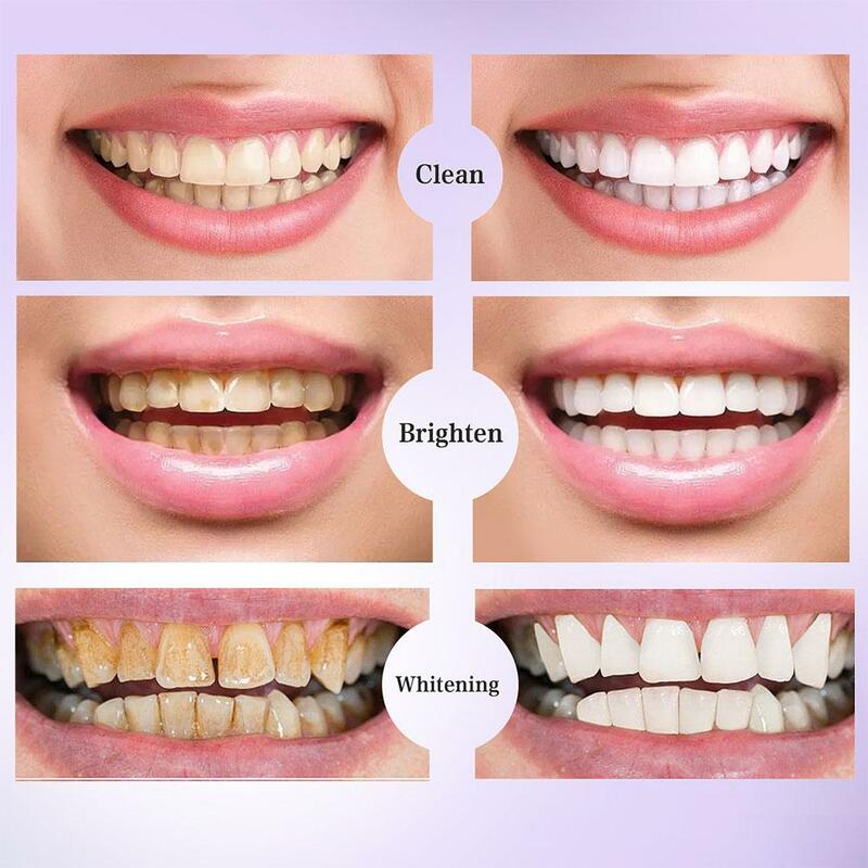 Creme dental roxo para clareamento dos dentes, essência de limpeza oral, clareamento da cor, cuidado amarelo, corrector dos dentes, soro C0H9