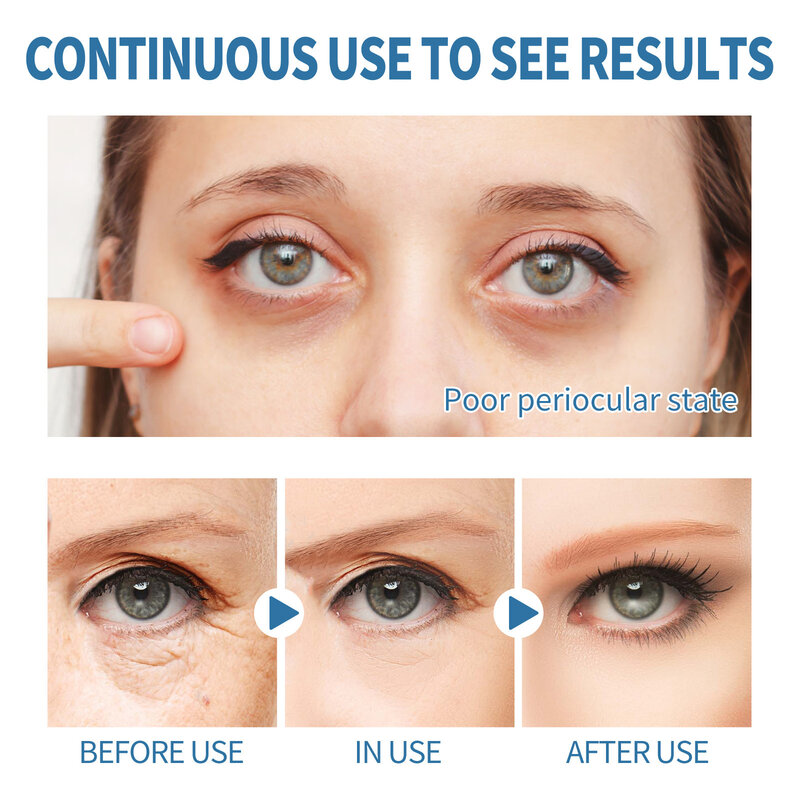 12pcs/Box Eye Gel Patch Reduce Wrinkles Eyes Dark Circles Eye Bags Moisturizing Anti-Wrinkle Eye Mask Patches With Hyaluronic