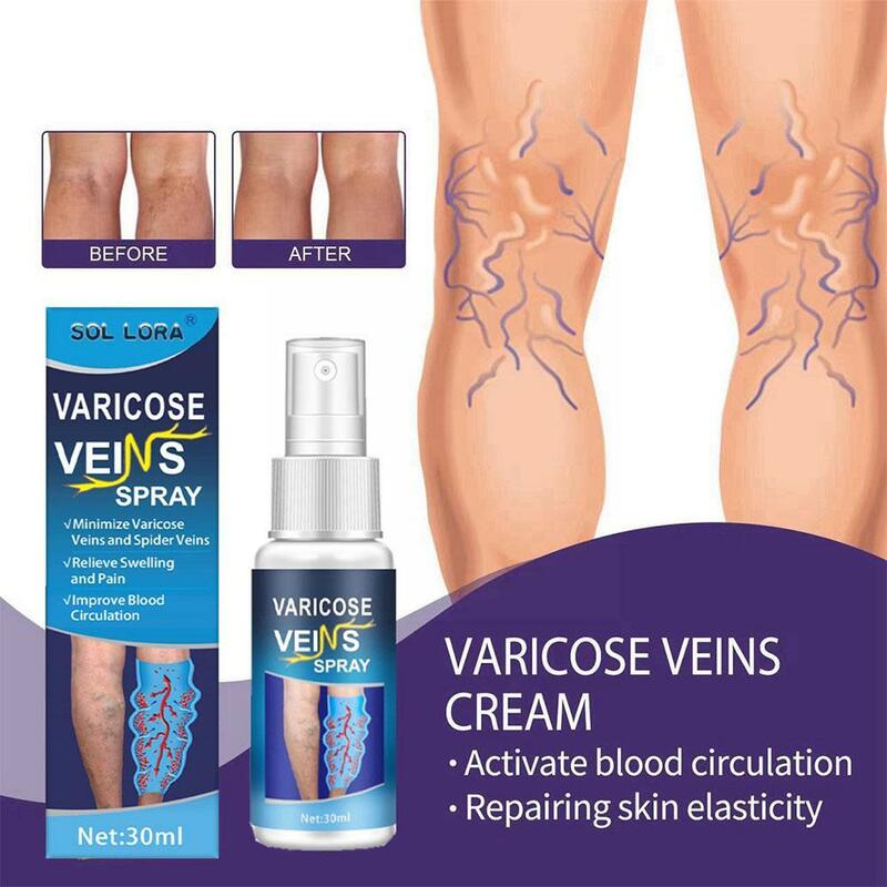 Veinhealing-Varizes Tratamento Spray, Suavizar o Sangue Sem Cirurgia, o Bulge Pernas Vasos, Minhoca de Cuidados Perna, S1O2