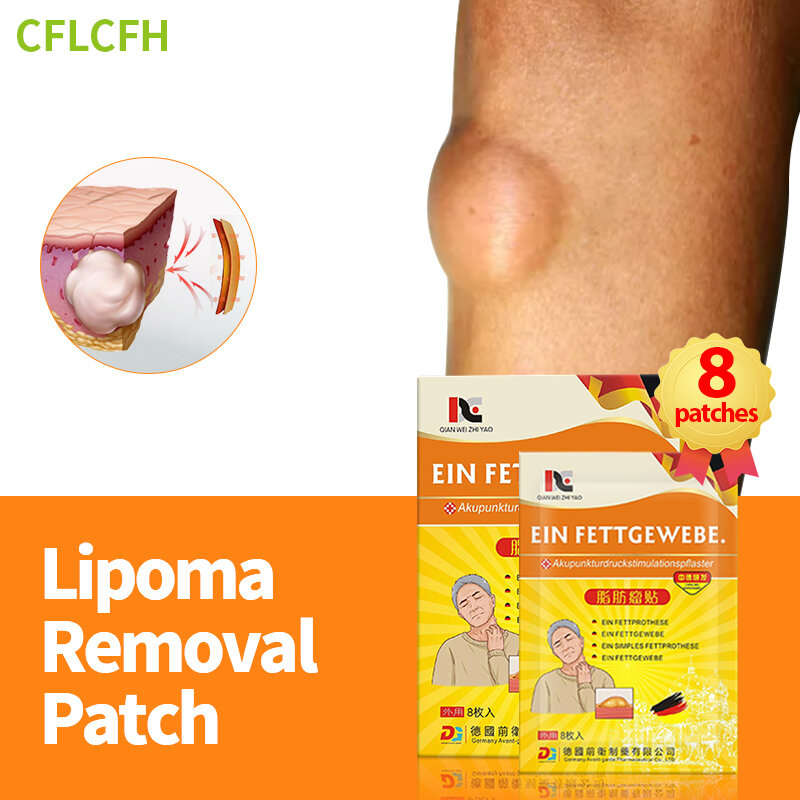 Germany Lipoma Removal Patch Fibroma Cellulite Remover Fat Lump Fat Mass Cream Solitary Multiple Lipoma Scyst Treatment Medicine