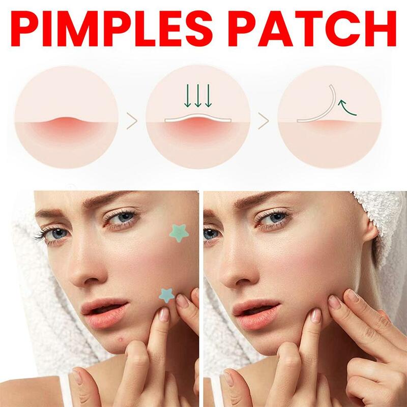 Star Pimple Patch para Remoção de Acne Adesivos coloridos e invisíveis para cuidados com a pele, Face Spot, Beauty Makeup Tool, 200PCs