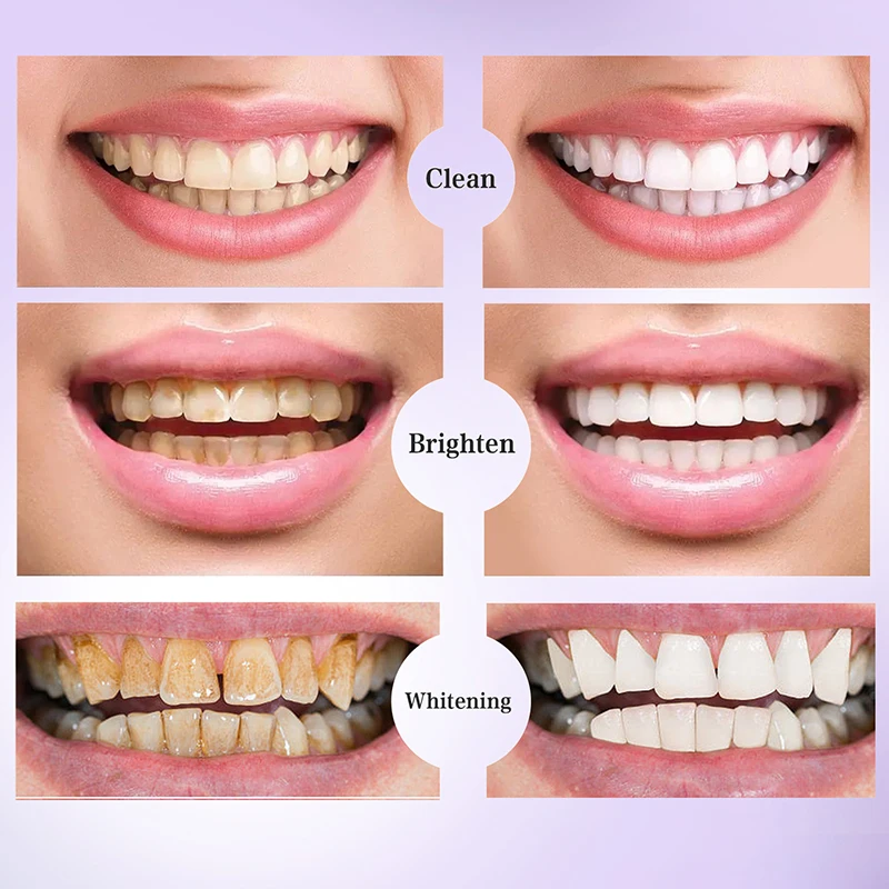 Pasta gigi pemutih ungu V34 30ml menghilangkan noda mengurangi perawatan tulang gigi untuk gusi mulut segar mencerahkan 2023 gigi