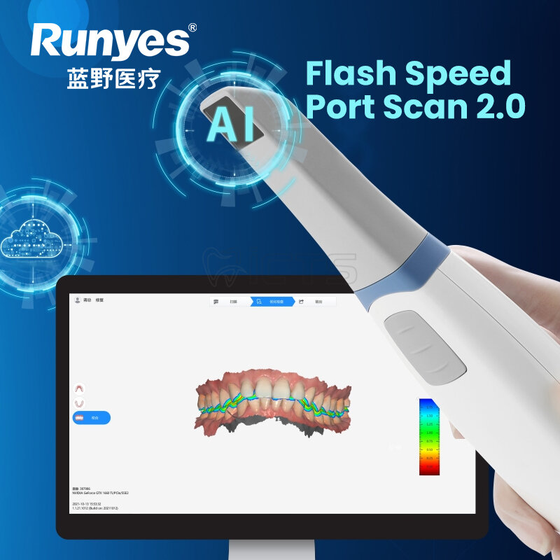 Runyes IOS-11 구강 내 스캐너, 인체공학적 스캐너, 헤드 디자인, 빠른 스캐닝, 쉬운 분해, AI 지능형 스캐닝
