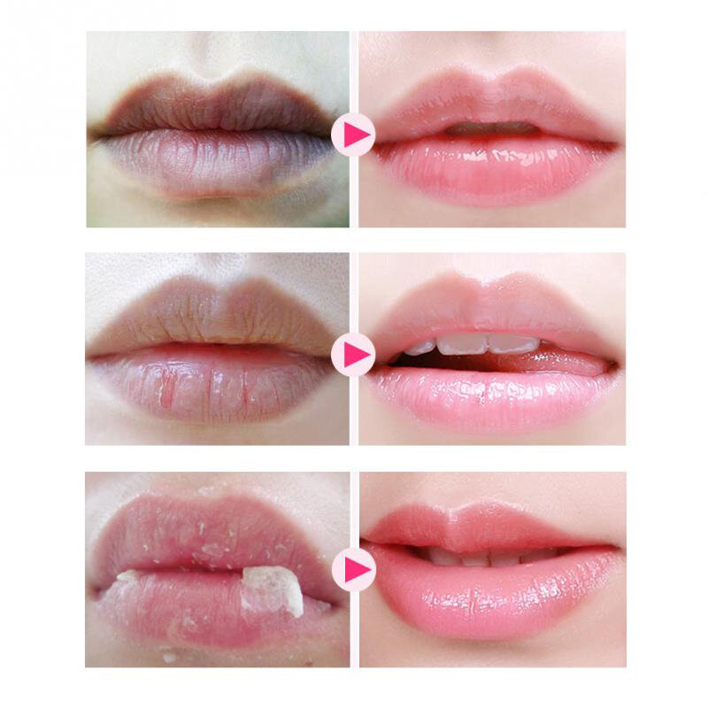 Masker bibir, 1 ~ 10 buah pelembab menenangkan meningkatkan anti-kerut melembabkan menutrisi alami untuk perawatan bibir bibir