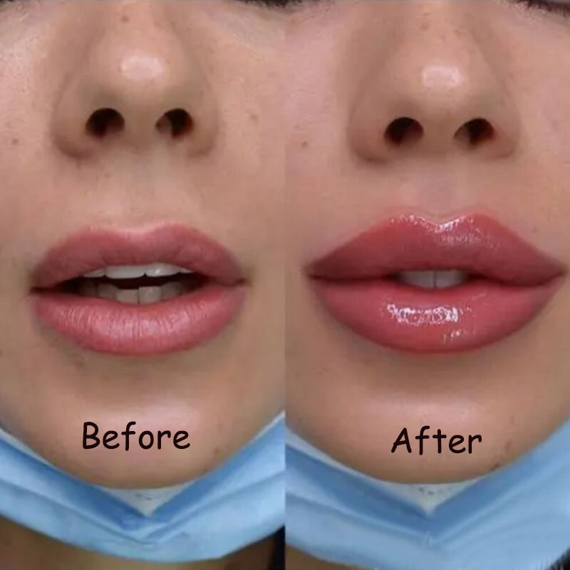 Instant Lip Enhancer praller Öl extrem voluminöse Lip gloss Serum nähren Anti-Falten sexy Lippen feuchtigkeit spendende Pflege Kosmetik
