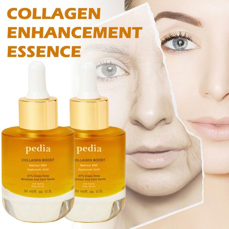 Essência de soro facial Collagen Boost, Anti-rugas, Anti-envelhecimento, clareamento, hidratante, cuidado facial, remoção de rugas, facial, 30ml