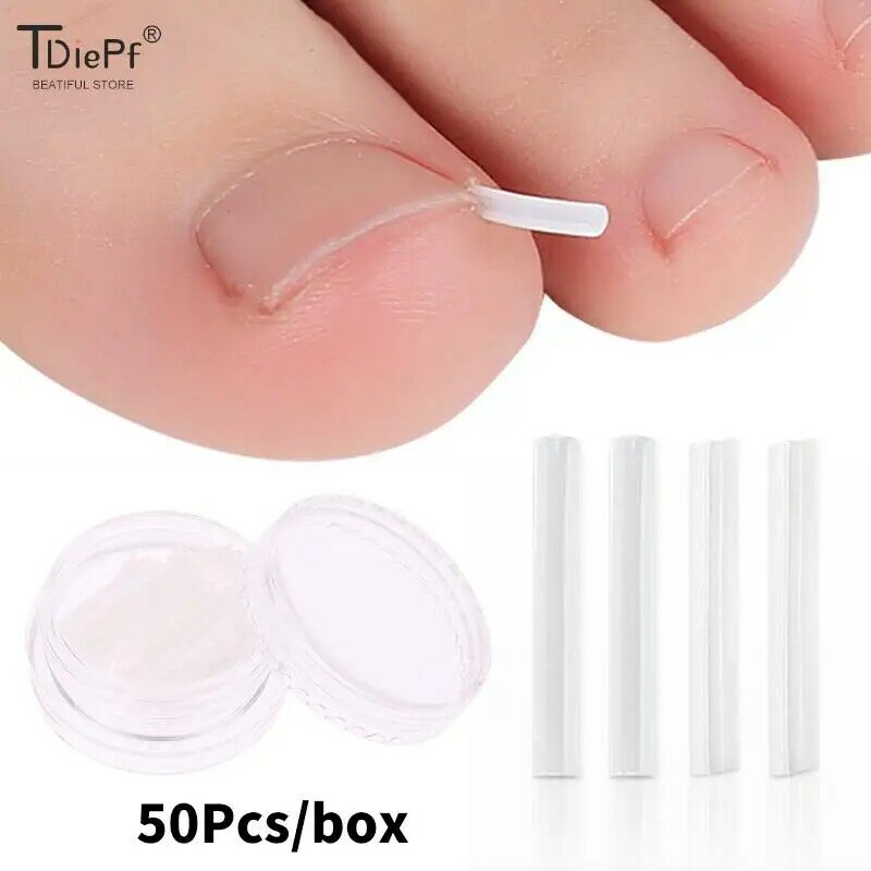 50Pc/box Ingrown Toenail Correction Tool Ingrown Toe Nail Treatment Elastic Patch Sticker Straightening Clip Brace Pedicure Tool