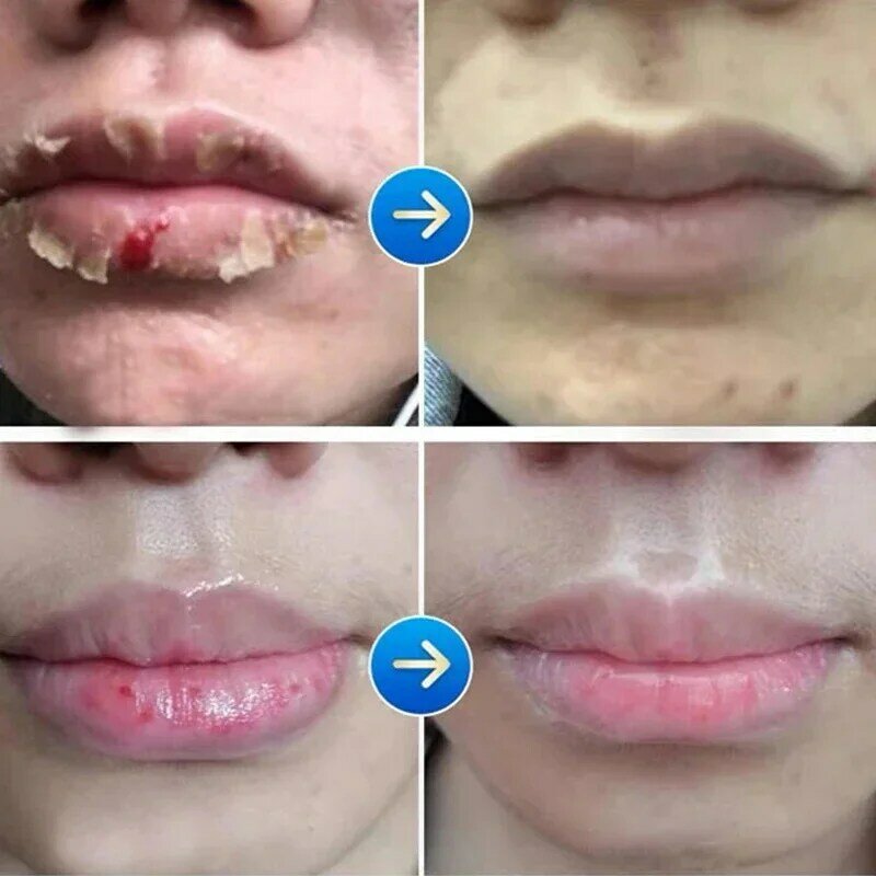 Mężczyźni balsam do ust nawilżający nawilżający, wyblakłe linie ust usuwają martwa skóra odświeżające i nie tłuste wykwintne pielęgnacja ust