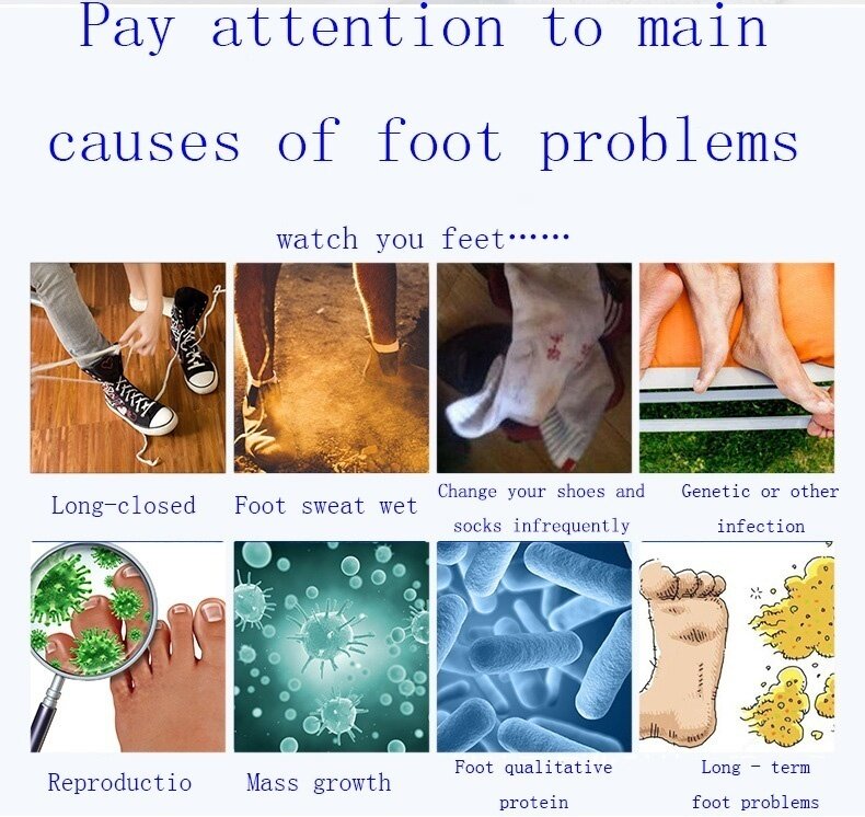 Dépistolet ant pour chaussures, spray efficace pour les pieds et les chaussures, 100ml, élimine les odeurs et les bactéries, CR9