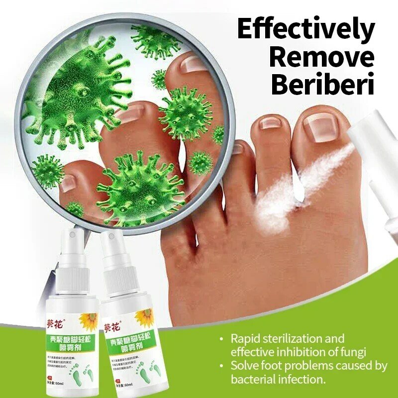 Spray anti-odeur de pied pour le traitement de Pedis, peeling des pieds d'athlète, antifongique, anti-démangeaisons, inhibe les champignons, médicament contre la sueur, tinea, béribéri