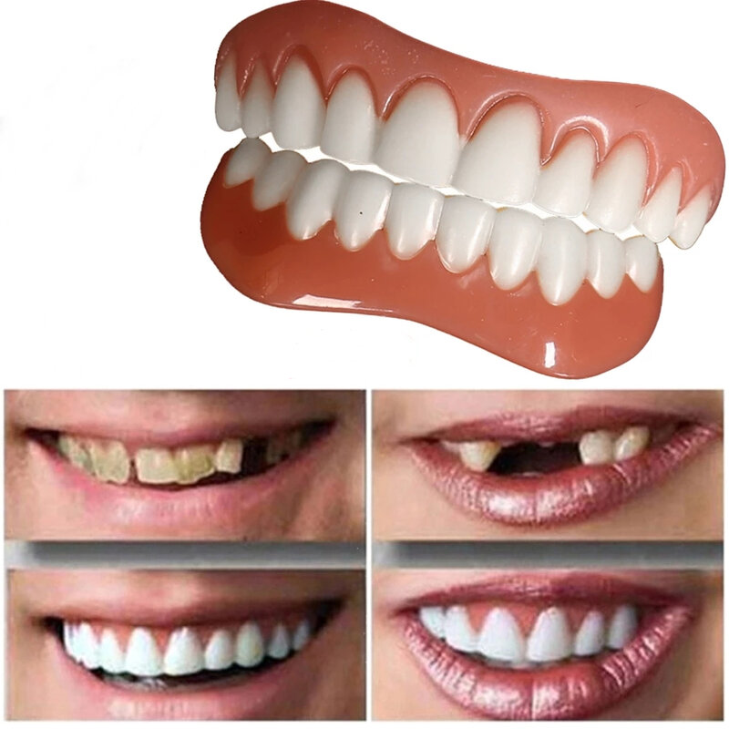 Carillas de silicona para dentadura, chapa con sonrisa perfecta, ortodoncia cómoda