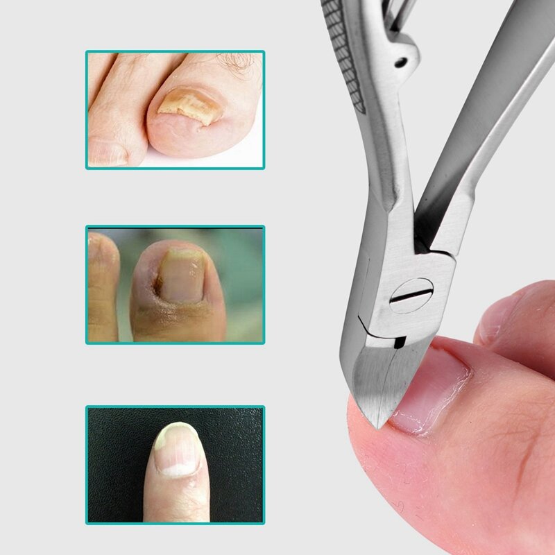 3X กรรไกรตัดตัดเล็บนิ้วเท้าสำหรับมืออาชีพอุปกรณ์ดูแลเท้าทำจากสแตนเลส