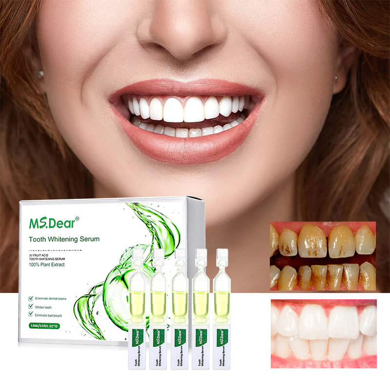 Serum pemutih gigi, produk gigi perawatan kebersihan mulut segar esensi pembersih noda plak penghilang Serum pemutih gigi 450/750ml