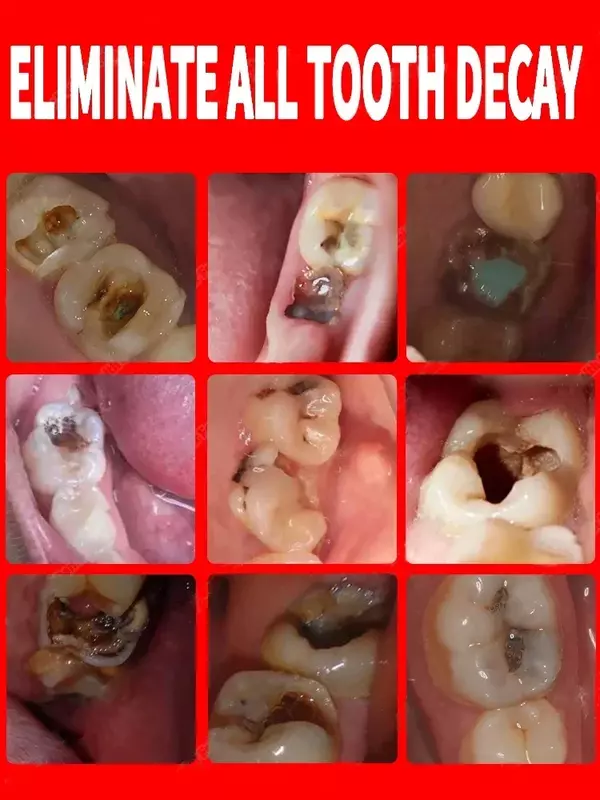 歯のホワイトニング、新鮮な息、歯ブラシの除去、歯痛の緩和