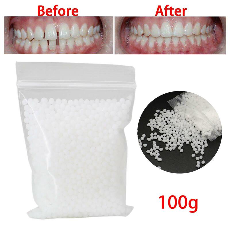 100G Temporäre Zahn Reparatur Kit Temporäre Zahn Reparatur Werkzeug Prothese Klebstoff Formbare Prothese für Große Lücken Aufhellung Zahn
