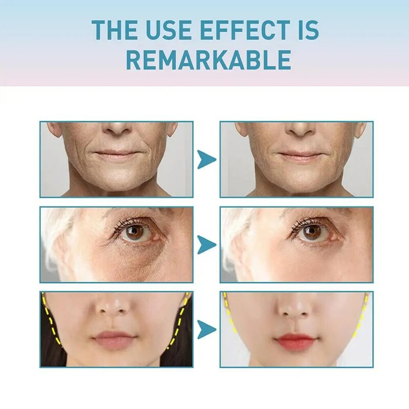 LOT Collagen Wrinkle Removal Cream Face Anti-aging Removing Wrinkle Fine Lines Nasolabial Folds Expression Lines Tighten Skin