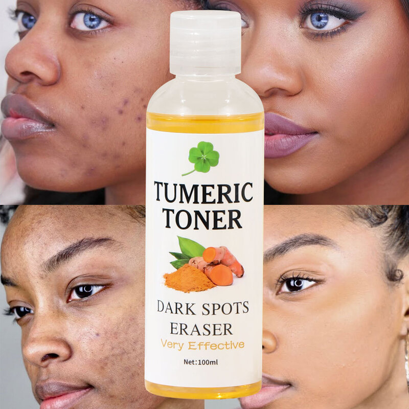 100ml Tumeric Dark Spots Toner Spots Eraser Corrector Turmeric Fade Blemishes Dark Spot Remover Toner For Dark Skin Care