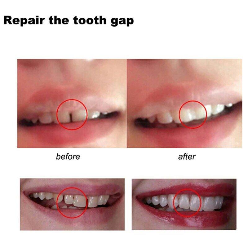 10G Kit Perbaikan Gigi Sementara Gigi dan Celah Gigi Palsu Lem Padat Alat Kecantikan Gigi Pemutih Gigi Perekat Gigi