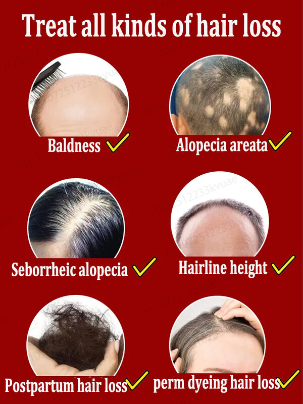 Aceite esencial de crecimiento rápido del cabello, repara la calvicie.