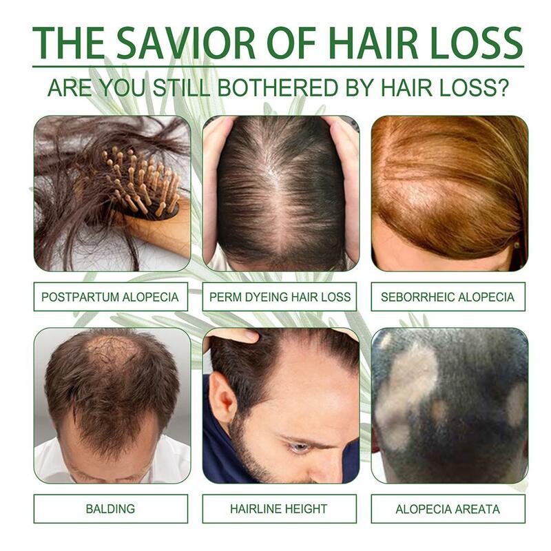 2/4X olejek eteryczny do pielęgnacji włosów z rozmarynu odżywia korzenie włosów, naprawia rozwidlenie włosów i uszkodzenia włosów, gładkość odżywia pielęgnację włosów Oi