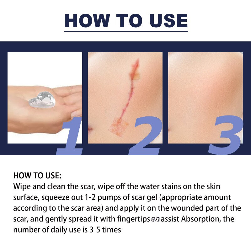 Silicone Scar Removal Cream, Gel de remoção de cicatriz, Cicatrizes cirúrgicas remover, Spider Repair Treat, Corretor de pigmentação clareamento