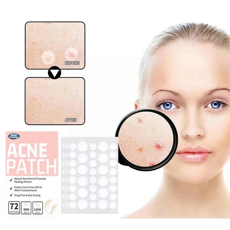 72Pcs Invisible Acne Patches Removal Pimple Anti-Acne Hydrocolloid Patches Spots Marks Concealer Repair Sticker Waterproof